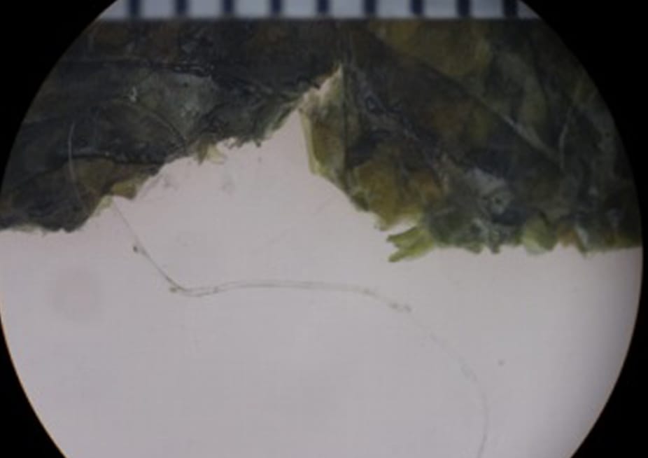 繊維状異物